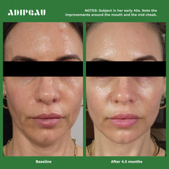 Volume Cream